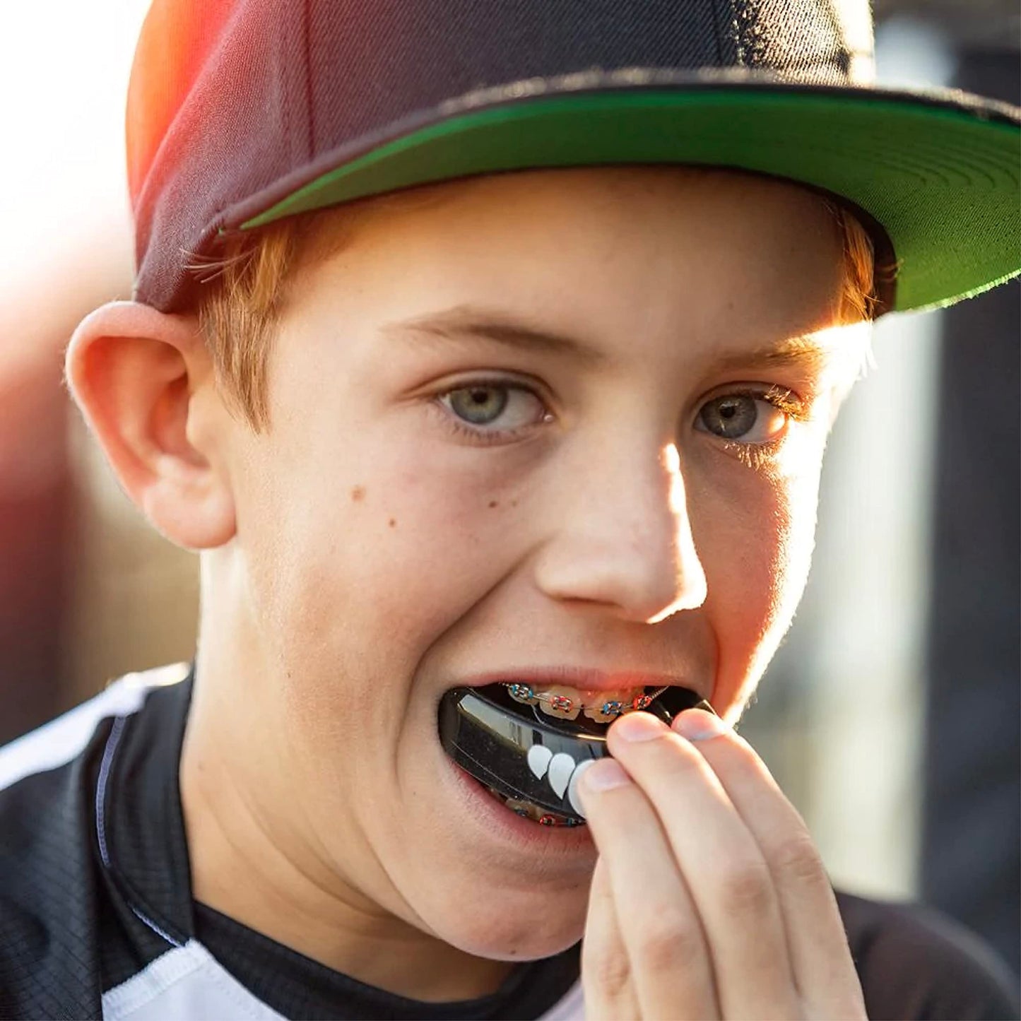 Shock Doctor Orthodontic Mouth Guard for Braces for Sports, Hockey, Lacrosse, Football, Baseball, Braces Mouth Guard, Upper Teeth Protection, Adult & Youth Mouth Guard Sizes